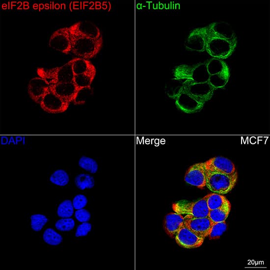 Immunocytochemistry/ Immunofluorescence: eIF2B epsilon Antibody (5M2D4) [NBP3-16674] - Confocal imaging of MCF7 cells using eIF2B epsilon Rabbit mAb  followed by a further incubation with Cy3 Goat Anti-Rabbit IgG (H+L)  . The cells were counterstained with alpha-Tubulin Mouse mAb  followed by incubation with ABflo 488-conjugated Goat Anti-Mouse IgG (H+L) Ab  (Green). DAPI was used for nuclear staining (Blue). Objective: 100x.