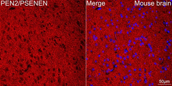 Immunocytochemistry/ Immunofluorescence: PSENEN/PEN2 Antibody (6J5O4) [NBP3-16676] - Confocal imaging of paraffin-embedded Mouse brain using PSENEN/PEN2 Rabbit mAb  followed by a further incubation with Cy3 Goat Anti-Rabbit IgG (H+L) . DAPI was used for nuclear staining (Blue). Objective: 40x. Perform microwave antigen retrieval with 0.01 M citrate buffer (pH 6.0) prior to IF staining.