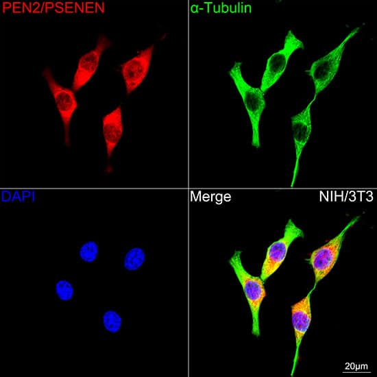 Immunocytochemistry/ Immunofluorescence: PSENEN/PEN2 Antibody (6J5O4) [NBP3-16676] - Confocal imaging of NIH/3T3 cells using PSENEN/PEN2 Rabbit mAb followed by a further incubation with Cy3 Goat Anti-Rabbit IgG (H+L) . The cells were counterstained with alpha-Tubulin Mouse mAb followed by incubation with ABflo(R) 488-conjugated Goat Anti-Mouse IgG (H+L) Ab (Green). DAPI was used for nuclear staining (Blue). Objective: 100x.