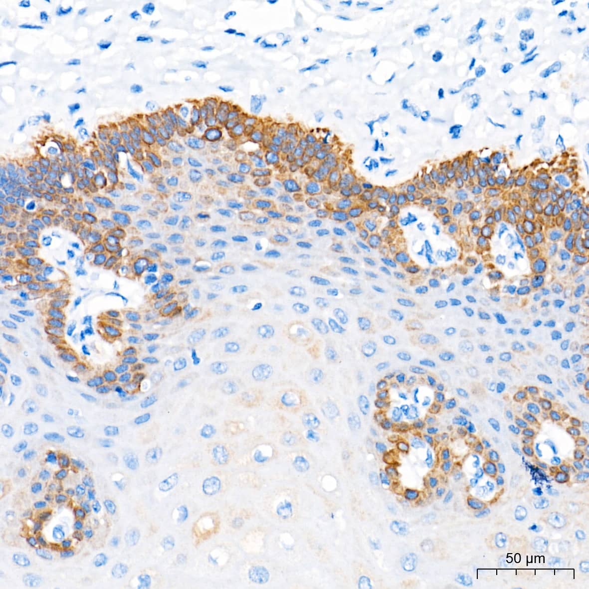 Immunohistochemistry: Cytokeratin 16 Antibody (8L6R4) [NBP3-16678] - Immunohistochemistry analysis of paraffin-embedded Human esophagus tissue using Cytokeratin 16 Rabbit mAb at a dilution of 1:1000 (40x lens). High pressure antigen retrieval performed with 0.01M Tris-EDTA Buffer (pH 9.0) prior to IHC staining.