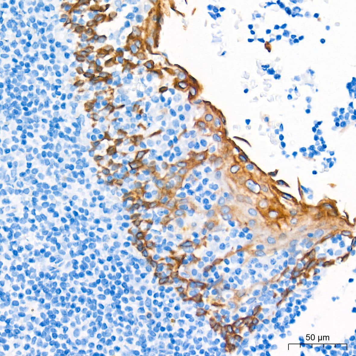 Immunohistochemistry: Cytokeratin 16 Antibody (8L6R4) [NBP3-16678] - Immunohistochemistry analysis of paraffin-embedded Human tonsil tissue using Cytokeratin 16 Rabbit mAb at a dilution of 1:1000 (40x lens). High pressure antigen retrieval performed with 0.01M Tris-EDTA Buffer (pH 9.0) prior to IHC staining.