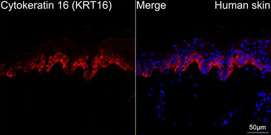 Immunocytochemistry/ Immunofluorescence: Cytokeratin 16 Antibody (8L6R4) [Cytokeratin 16] - Confocal imaging of paraffin-embedded Human skin using Cytokeratin 16 Rabbit mAb  followed by a further incubation with Cy3 Goat Anti-Rabbit IgG (H+L)  . DAPI was used for nuclear staining (Blue). Objective: 40x. Perform high pressure antigen retrieval with 0.01 M citrate buffer (pH 6.0) prior to IF staining.