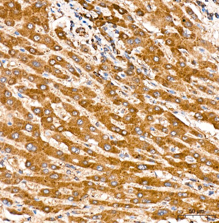 Immunohistochemistry-Paraffin: Ndufs4 Antibody (6T10F4) [NBP3-16679] - Analysis of NDUFS4 in paraffin-embedded human liver tissue using NDUFS4 Rabbit mAb at a dilution of 1:400 (40x lens). High pressure antigen retrieval was performed with 0.01 M citrate buffer (pH 6.0) prior to IHC staining.