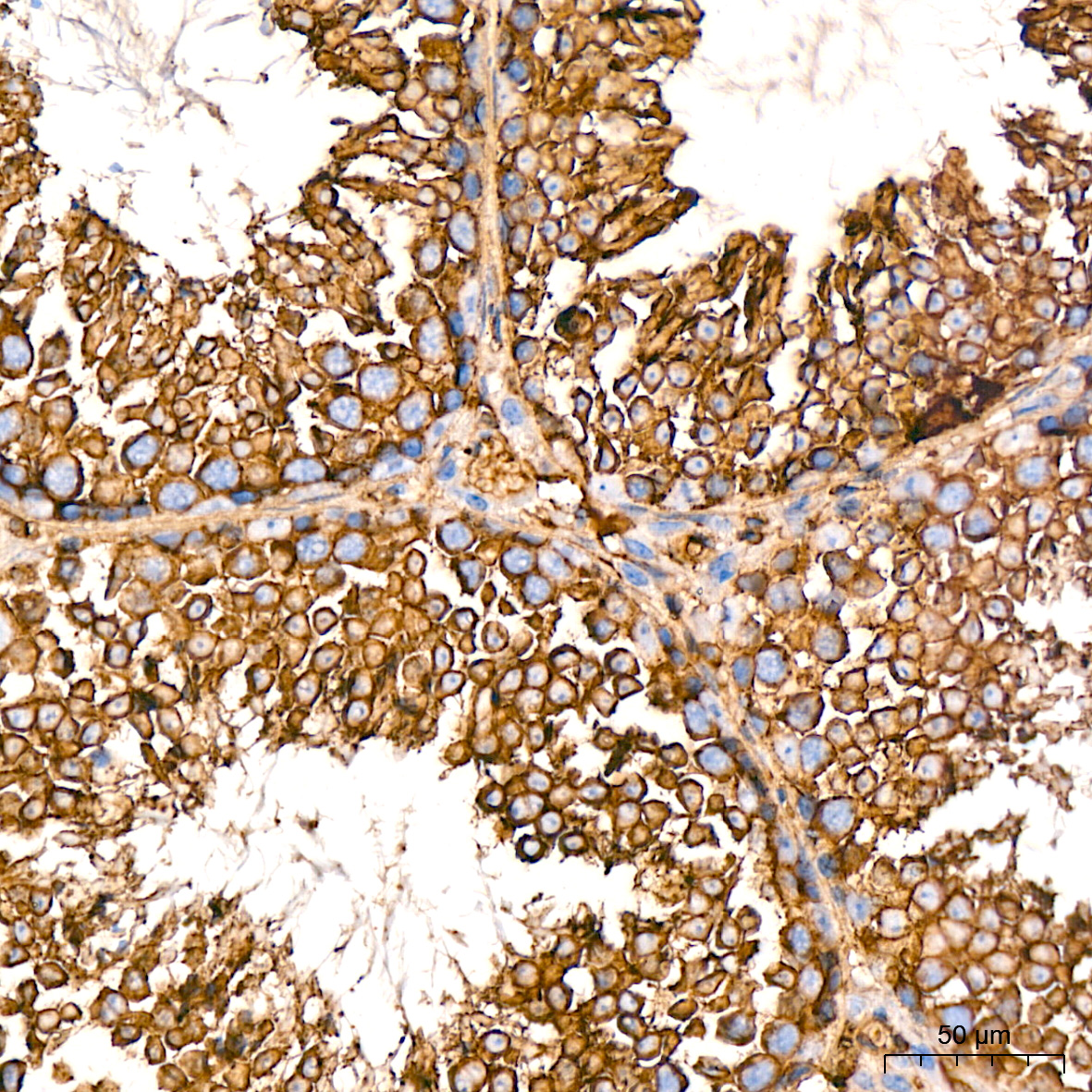 Immunohistochemistry Somatostatin R5/SSTR5 Antibody (4O6N5)