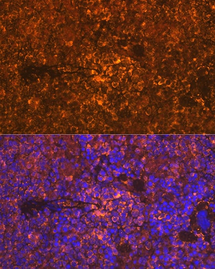 Immunocytochemistry/ Immunofluorescence: Oncostatin M/OSM Antibody (8O8K9) [Oncostatin M/OSM] - Immunofluorescence analysis of paraffin-embedded rat spleen using Oncostatin M/OSM Rabbit mAb  at dilution of 1:100 (40x lens). Secondary antibody: Cy3-conjugated Goat anti-Rabbit IgG (H+L)  at 1:500 dilution. Blue: DAPI for nuclear staining.