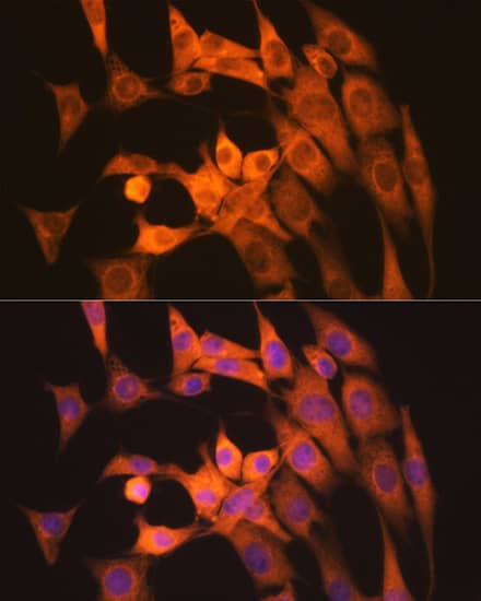 Immunocytochemistry/ Immunofluorescence: Calpain 1 Antibody (10E6O5) [NBP3-16687] - Immunofluorescence analysis of NIH/3T3 cells using Calpain 1 Rabbit mAb  at dilution of 1:100 (40x lens). Blue: DAPI for nuclear staining.