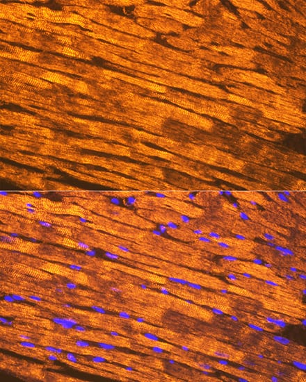 Immunocytochemistry/ Immunofluorescence: Tropomyosin-1 Antibody (5Q2H6) [NBP3-16689] - Immunofluorescence analysis of paraffin-embedded mouse heart using Tropomyosin-1 Rabbit mAb at dilution of 1:100 (40x lens). Secondary antibody: Cy3 Goat Anti-Rabbit IgG (H+L) at 1:500 dilution. Blue: DAPI for nuclear staining.