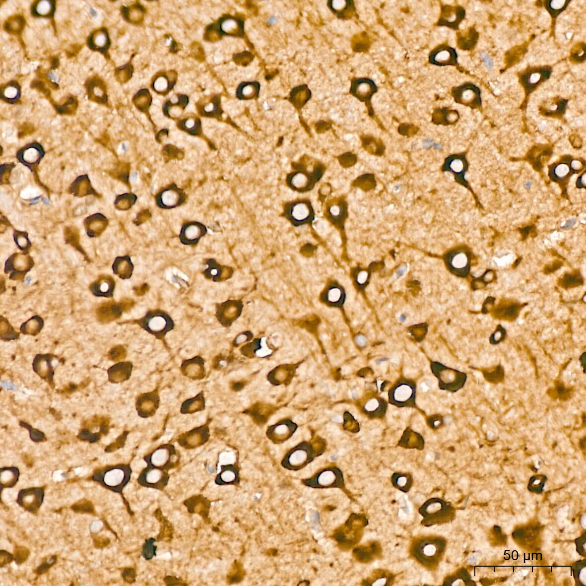 Immunohistochemistry: EEF1G Antibody (2E1O7) [NBP3-16694] - Immunohistochemistry analysis of EEF1G in paraffin-embedded rat brain tissue using EEF1G Rabbit mAb  at a dilution of 1:800 (40x lens).High pressure antigen retrieval was performed with 0.01 M citrate buffer (pH 6.0) prior to IHC staining.