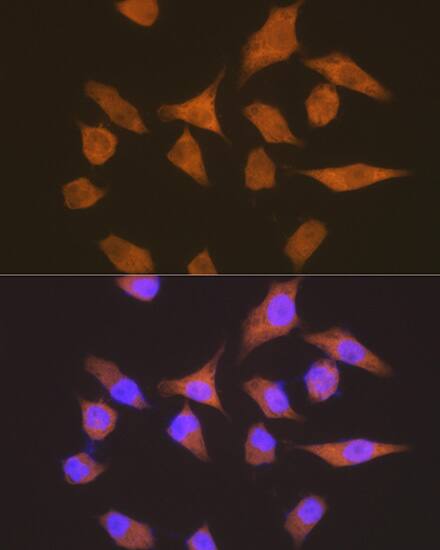 Immunocytochemistry/ Immunofluorescence: EEF1G Antibody (2E1O7) [NBP3-16694] - Immunofluorescence analysis of HeLa cells using EEF1G Rabbit mAb  at dilution of 1:100 (40x lens). Blue: DAPI for nuclear staining.