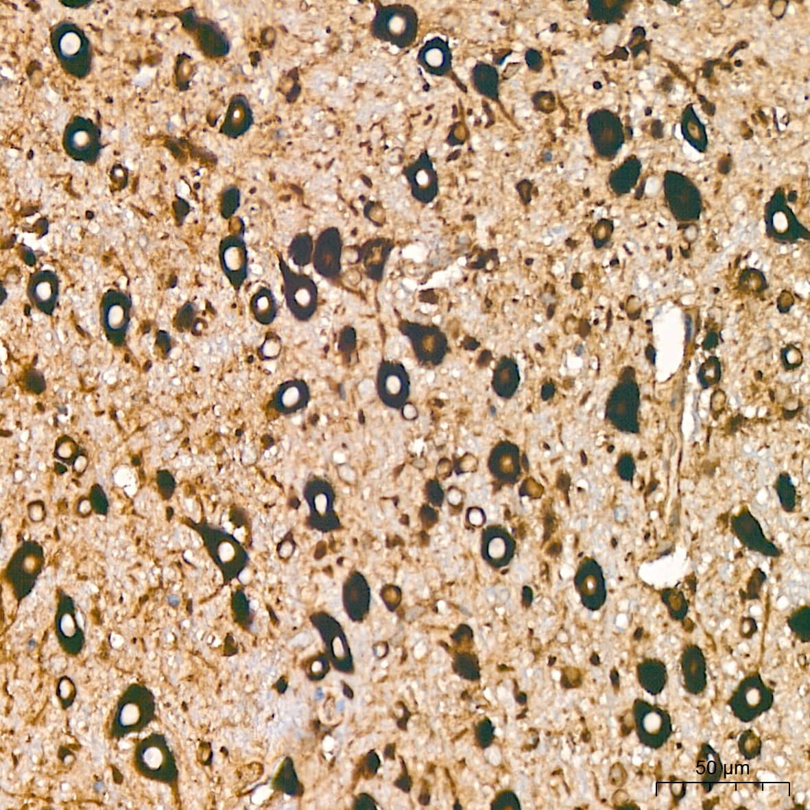 Immunohistochemistry: EEF1G Antibody (2E1O7) [NBP3-16694] - Immunohistochemistry analysis of EEF1G in paraffin-embedded mouse brain tissue using EEF1G Rabbit mAb  at a dilution of 1:800 (40x lens).High pressure antigen retrieval was performed with 0.01 M citrate buffer (pH 6.0) prior to IHC staining.