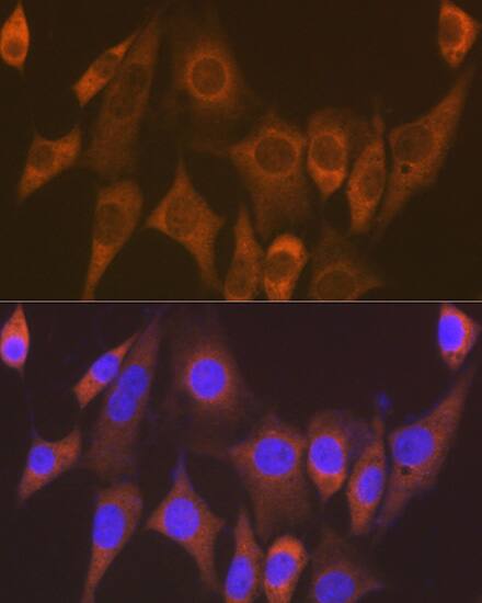Immunocytochemistry/ Immunofluorescence: EEF1G Antibody (2E1O7) [NBP3-16694] - Immunofluorescence analysis of NIH-3T3 cells using EEF1G Rabbit mAb  at dilution of 1:100 (40x lens). Blue: DAPI for nuclear staining.