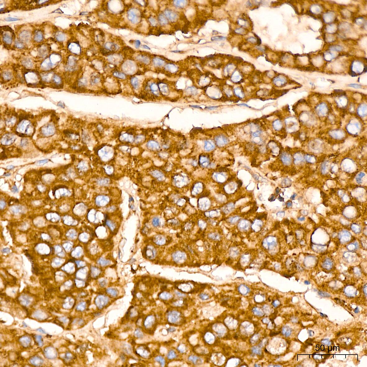 Immunohistochemistry: EEF1G Antibody (2E1O7) [NBP3-16694] - Immunohistochemistry analysis of EEF1G in paraffin-embedded human liver tissue using EEF1G Rabbit mAb  at a dilution of 1:800 (40x lens).High pressure antigen retrieval was performed with 0.01 M citrate buffer (pH 6.0) prior to IHC staining.