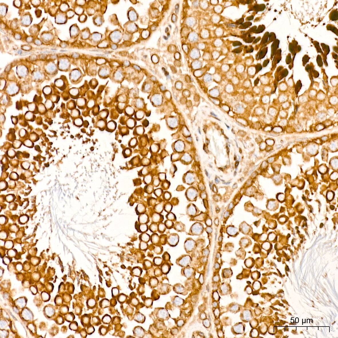 Immunohistochemistry: RanGAP1 Antibody (1E7R7) [NBP3-16697] - Immunohistochemistry analysis of RanGAP1 in paraffin-embedded rat testis tissue using RanGAP1 Rabbit mAb  at a dilution of 1:200 (40x lens). High pressure antigen retrieval was performed with 0.01 M citrate buffer (pH 6.0) prior to IHC staining.