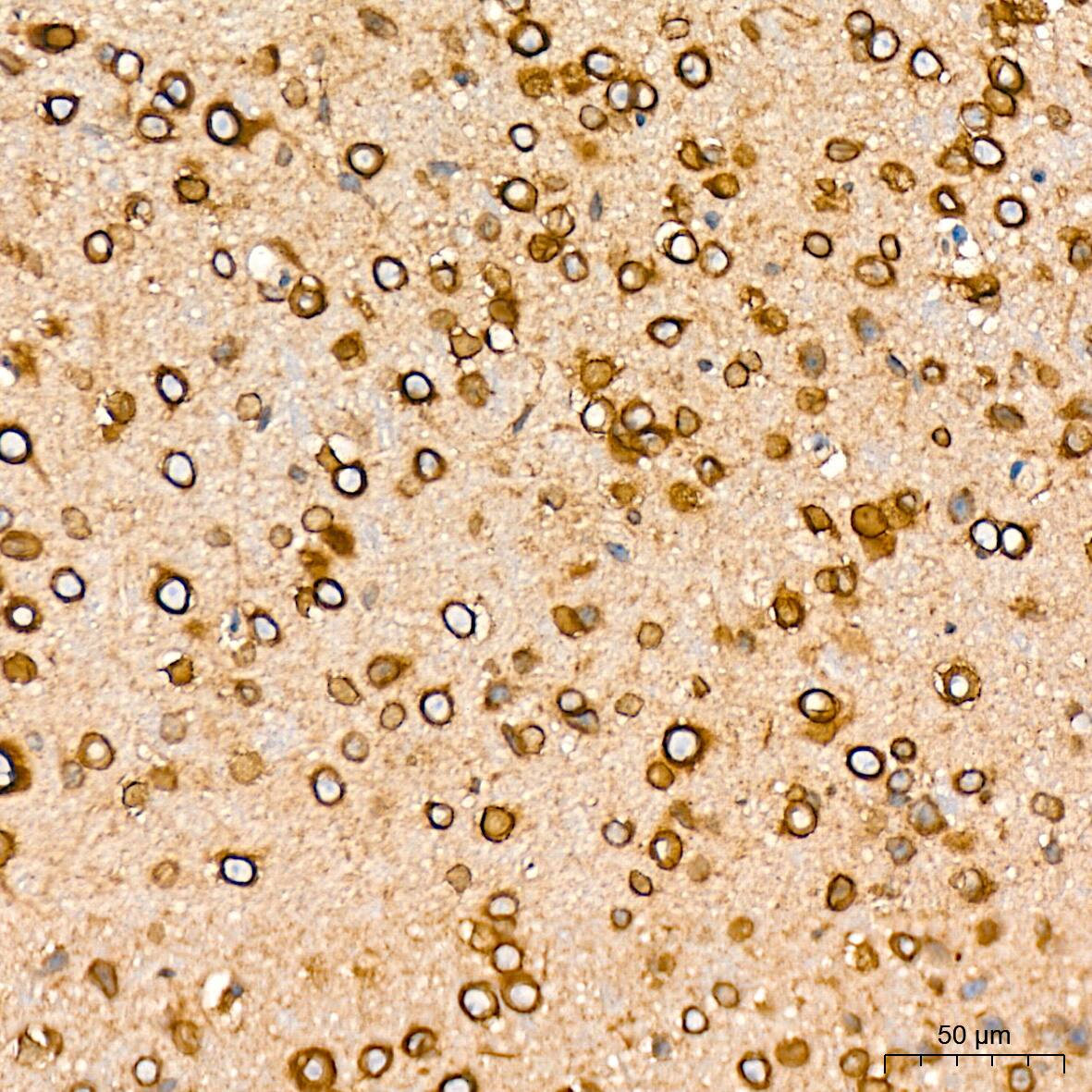 Immunohistochemistry: RanGAP1 Antibody (1E7R7) [NBP3-16697] - Immunohistochemistry analysis of RanGAP1 in paraffin-embedded mouse brain tissue using RanGAP1 Rabbit mAb  at a dilution of 1:200 (40x lens). High pressure antigen retrieval was performed with 0.01 M citrate buffer (pH 6.0) prior to IHC staining.