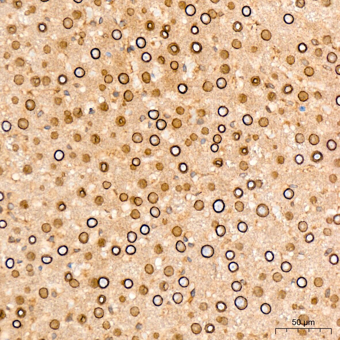 Immunohistochemistry: RanGAP1 Antibody (1E7R7) [NBP3-16697] - Immunohistochemistry analysis of RanGAP1 in paraffin-embedded rat liver tissue using RanGAP1 Rabbit mAb  at a dilution of 1:200 (40x lens). High pressure antigen retrieval was performed with 0.01 M citrate buffer (pH 6.0) prior to IHC staining.