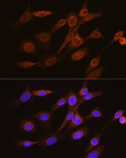 Immunocytochemistry/ Immunofluorescence: RanGAP1 Antibody (1E7R7) [NBP3-16697] - Immunofluorescence analysis of NIH-3T3 cells using RanGAP1 Rabbit mAb  at dilution of 1:100 (40x lens). Secondary antibody: Cy3 Goat Anti-Rabbit IgG (H+L)  at 1:500 dilution. Blue: DAPI for nuclear staining.