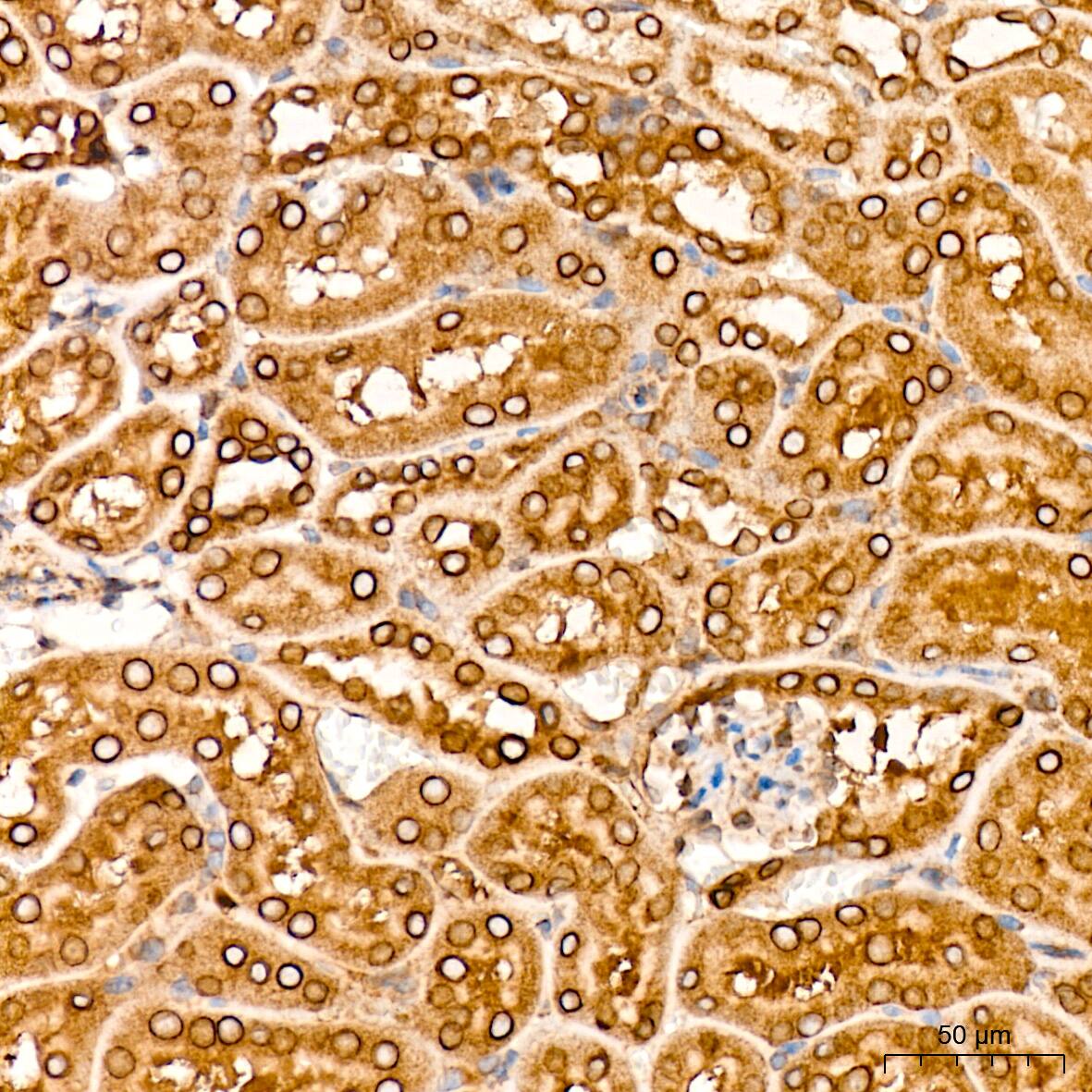 Immunohistochemistry: RanGAP1 Antibody (1E7R7) [NBP3-16697] - Immunohistochemistry analysis of RanGAP1 in paraffin-embedded mouse kidney tissue using RanGAP1 Rabbit mAb  at a dilution of 1:200 (40x lens). High pressure antigen retrieval was performed with 0.01 M citrate buffer (pH 6.0) prior to IHC staining.