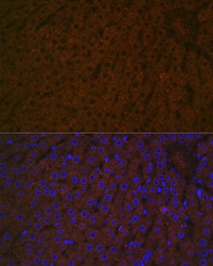 Immunocytochemistry/ Immunofluorescence: Haptoglobin Antibody (7C1N2) [NBP3-16700] - Immunofluorescence analysis of paraffin-embedded rat liver using Haptoglobin (HP) Rabbit mAb at dilution of 1:100 (40x lens). Secondary antibody: Cy3 Goat Anti-Rabbit IgG (H+L) at 1:500 dilution. Blue: DAPI for nuclear staining.