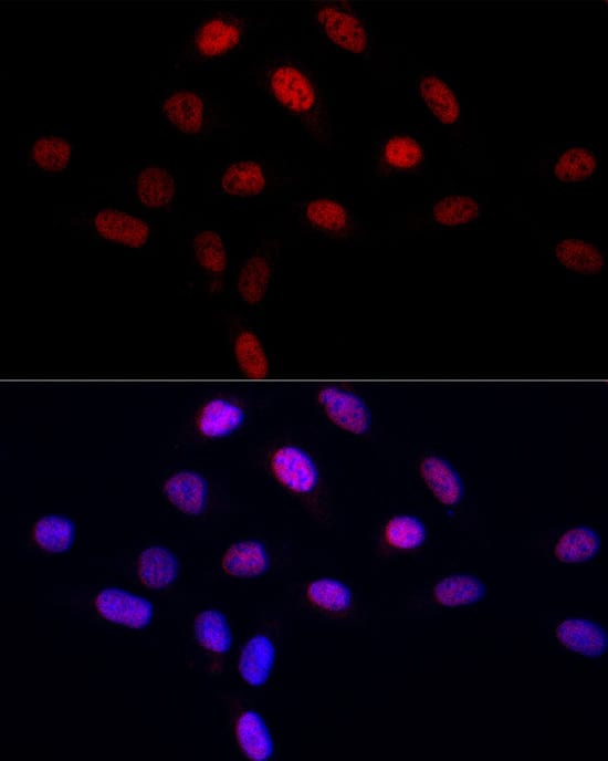 Immunocytochemistry/ Immunofluorescence: LEO1 Antibody - Azide and BSA Free [NBP3-16704] - Immunofluorescence analysis of U2OS cells using LEO1 Rabbit pAb at dilution of 1:50 (40x lens). Secondary antibody: Cy3 Goat Anti-Rabbit IgG (H+L) at 1:500 dilution. Blue: DAPI for nuclear staining.