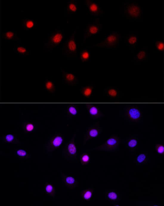 Immunocytochemistry/ Immunofluorescence: LEO1 Antibody - Azide and BSA Free [NBP3-16704] - Immunofluorescence analysis of NIH/3T3 cells using LEO1 Rabbit pAb at dilution of 1:50 (40x lens). Secondary antibody: Cy3 Goat Anti-Rabbit IgG (H+L) at 1:500 dilution. Blue: DAPI for nuclear staining.