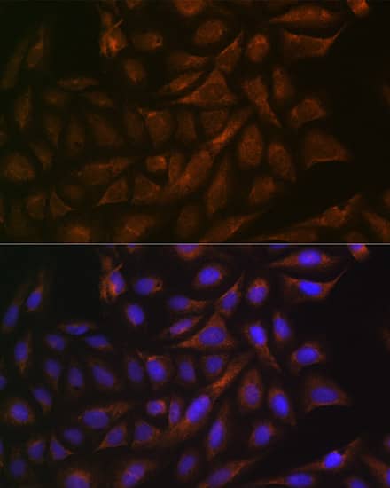 Immunocytochemistry/ Immunofluorescence: VAMP3/Cellubrevin Antibody (2H8R8) [NBP3-16705] - Immunofluorescence analysis of U-2 OS cells using VAMP3/VAMP3/Cellubrevin Rabbit mAb  at dilution of 1:100 (40x lens). Secondary antibody: Cy3 Goat Anti-Rabbit IgG (H+L)  at 1:500 dilution. Blue: DAPI for nuclear staining.