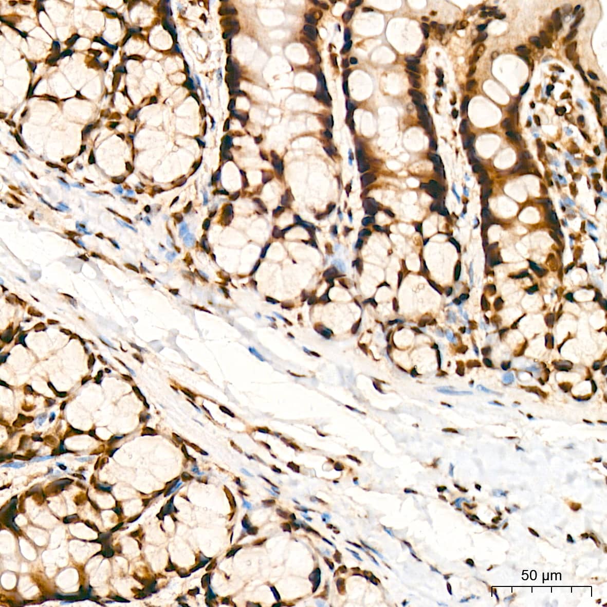 Immunohistochemistry: Bub3 Antibody (10G1S6) [NBP3-16709] - Immunohistochemistry analysis of Bub3 in paraffin-embedded rat colon tissue using Bub3 Rabbit mAb  at a dilution of 1:200 (40x lens). High pressure antigen retrieval was performed with 0.01 M citrate buffer (pH 6.0) prior to IHC staining.