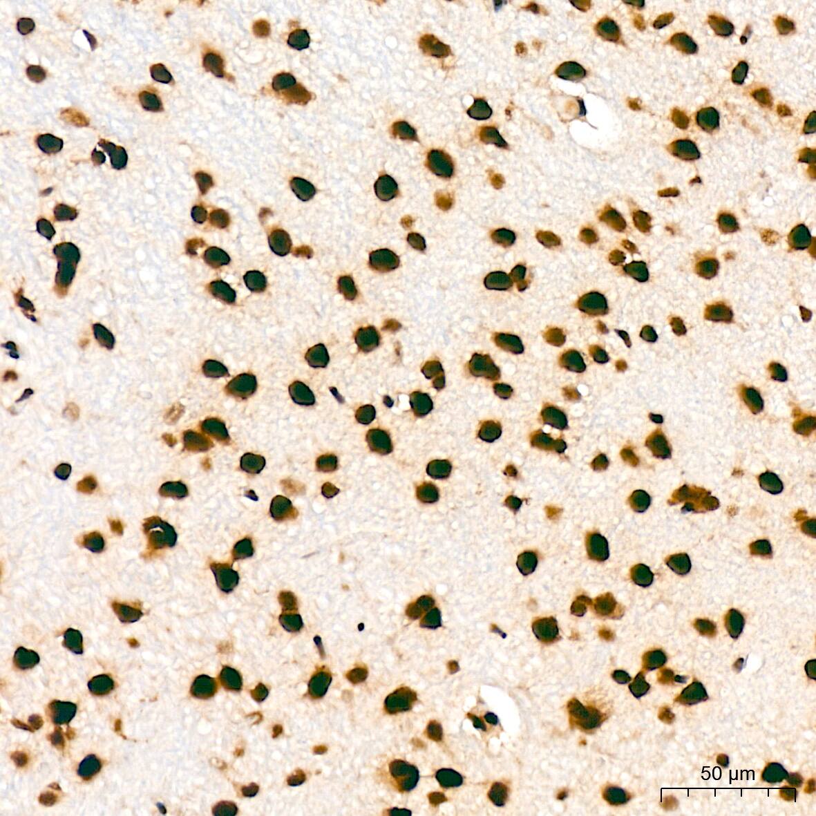 Immunohistochemistry: Bub3 Antibody (10G1S6) [NBP3-16709] - Immunohistochemistry analysis of Bub3 in paraffin-embedded rat brain tissue using Bub3 Rabbit mAb  at a dilution of 1:200 (40x lens). High pressure antigen retrieval was performed with 0.01 M citrate buffer (pH 6.0) prior to IHC staining.