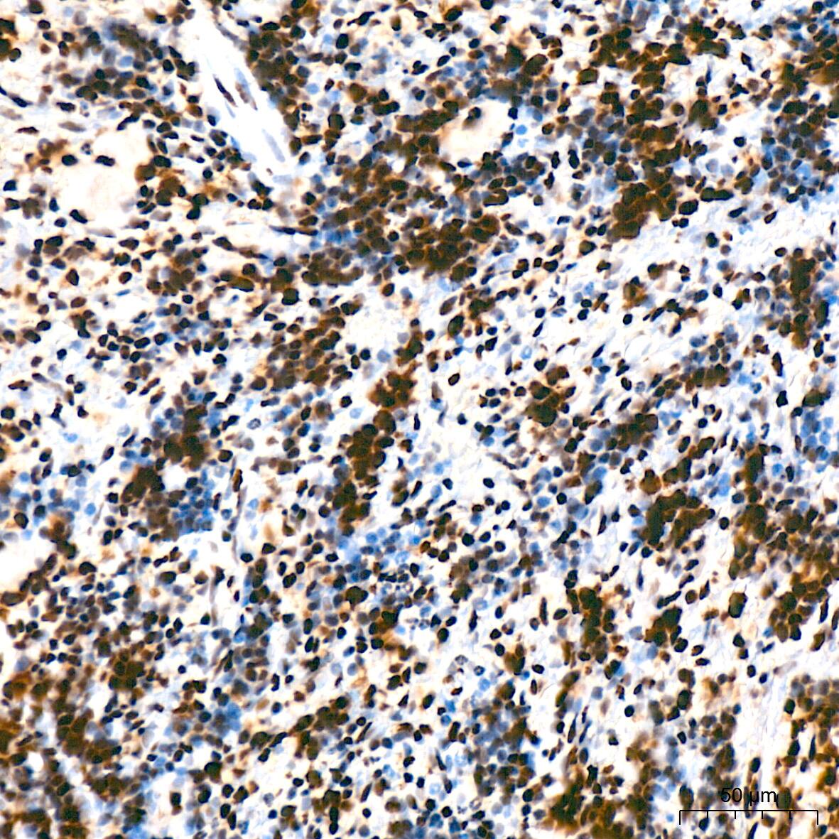 Immunohistochemistry: Bub3 Antibody (10G1S6) [NBP3-16709] - Immunohistochemistry analysis of Bub3 in paraffin-embedded rat spleen tissue using Bub3 Rabbit mAb  at a dilution of 1:200 (40x lens). High pressure antigen retrieval was performed with 0.01 M citrate buffer (pH 6.0) prior to IHC staining.