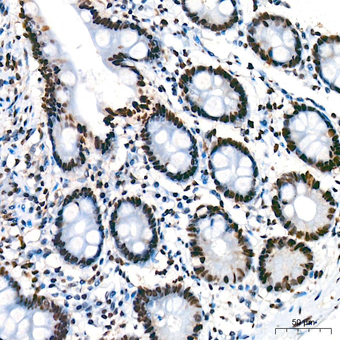 Immunohistochemistry: Bub3 Antibody (10G1S6) [NBP3-16709] - Immunohistochemistry analysis of Bub3 in paraffin-embedded human colon tissue using Bub3 Rabbit mAb  at a dilution of 1:200 (40x lens). High pressure antigen retrieval was performed with 0.01 M citrate buffer (pH 6.0) prior to IHC staining.