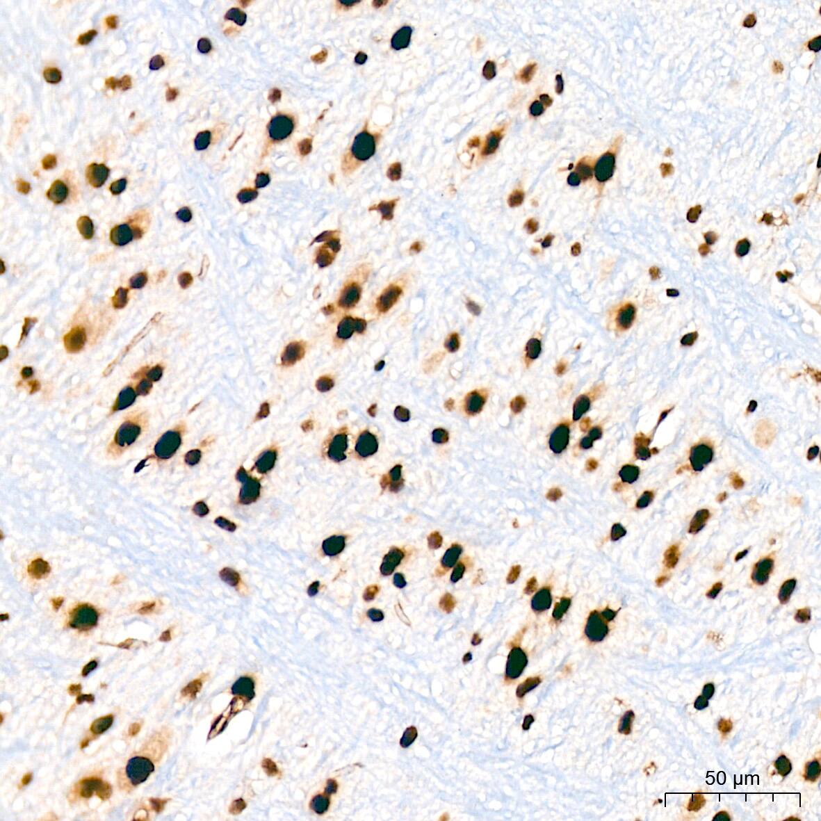 Immunohistochemistry: Bub3 Antibody (10G1S6) [NBP3-16709] - Immunohistochemistry analysis of Bub3 in paraffin-embedded mouse brain tissue using Bub3 Rabbit mAb  at a dilution of 1:200 (40x lens). High pressure antigen retrieval was performed with 0.01 M citrate buffer (pH 6.0) prior to IHC staining.