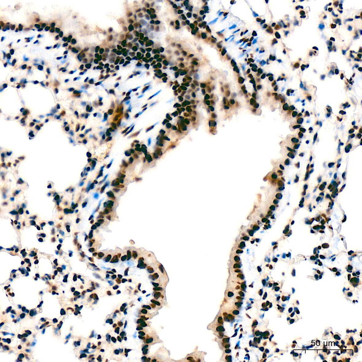 Immunohistochemistry: Bub3 Antibody (10G1S6) [NBP3-16709] - Immunohistochemistry analysis of Bub3 in paraffin-embedded mouse lung tissue using Bub3 Rabbit mAb  at a dilution of 1:200 (40x lens). High pressure antigen retrieval was performed with 0.01 M citrate buffer (pH 6.0) prior to IHC staining.