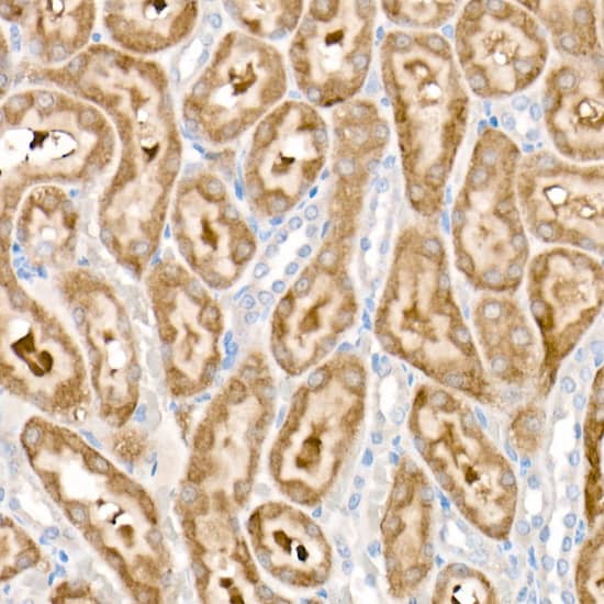 Immunohistochemistry: Pyruvate Dehydrogenase Kinase 1/PDK1 Antibody (5T6S8) [NBP3-16720] - Immunohistochemistry analysis of paraffin-embedded Rat kidney using Pyruvate Dehydrogenase Kinase 1/PDK1 Rabbit mAb at dilution of 1:1000 (40x lens). High pressure antigen retrieval performed with 0.01M Citrate Bufferr (pH 6.0) prior to IHC staining.