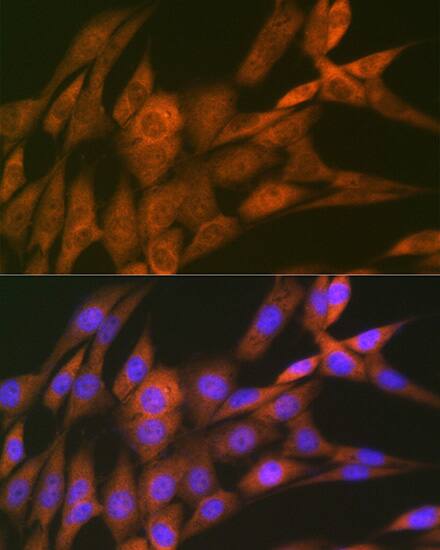 Immunocytochemistry/ Immunofluorescence: 14-3-3 tau/theta Antibody (9G6M4) [NBP3-16722] - Immunofluorescence analysis of NIH-3T3 cells using 14-3-3 tau/theta Rabbit mAb  at dilution of 1:100 (40x lens). Blue: DAPI for nuclear staining.