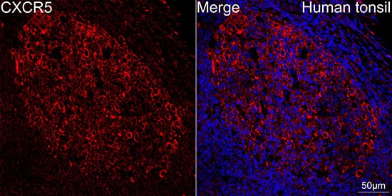 Immunocytochemistry/ Immunofluorescence: CXCR5 Antibody (9Q10I2) [NBP3-16723] - Confocal imaging of human tonsil using CXCR5 Rabbit mAb. DAPI was used for nuclear staining (blue). Objective: 40x.Perform high pressure antigen retrieval with 10 mM citrate buffer pH 6.0 before commencing with IF staining protocol.