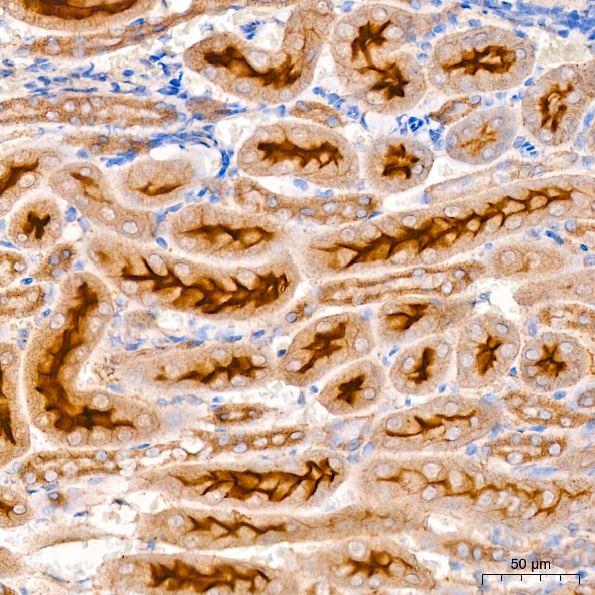 Immunohistochemistry: Xanthine Oxidase Antibody (0M8E7) [NBP3-16735] - Immunohistochemistry analysis of paraffin-embedded Mouse kidney using Xanthine Oxidase Rabbit mAb at dilution of 1:200 (40x lens). High pressure antigen retrieval performed with 0.01M Citrate Bufferr (pH 6.0) prior to IHC staining.