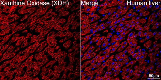 Immunocytochemistry/ Immunofluorescence: Xanthine Oxidase Antibody (0M8E7) [NBP3-16735] - Confocal imaging of paraffin-embedded Human liver using Xanthine Oxidase Rabbit mAb followed by a further incubation with Cy3 Goat Anti-Rabbit IgG (H+L) . DAPI was used for nuclear staining (Blue). Objective: 40x. Perform high pressure antigen retrieval with 0.01 M citrate buffer (pH 6.0) prior to IF staining.