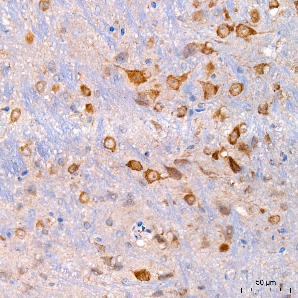 Immunohistochemistry: Xanthine Oxidase Antibody (0M8E7) [Xanthine Oxidase] - Immunohistochemistry analysis of paraffin-embedded Mouse brain using Xanthine Oxidase Rabbit mAb  at dilution of 1:200 (40x lens). High pressure antigen retrieval performed with 0.01M Citrate Bufferr (pH 6.0) prior to IHC staining.