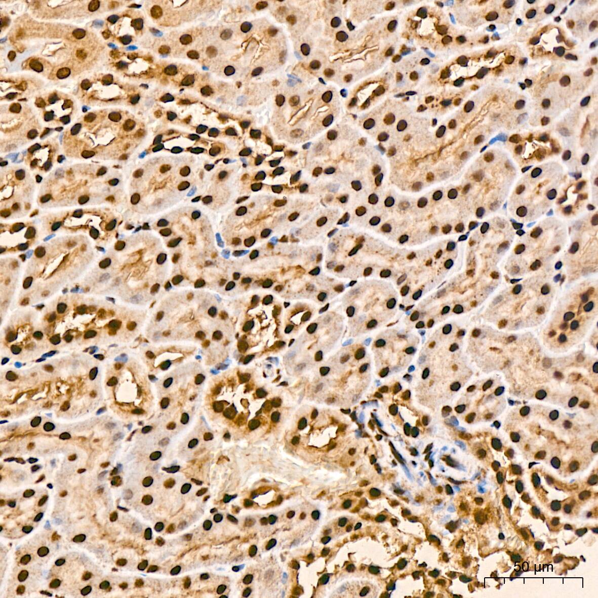 Immunohistochemistry: SFRS3 Antibody (9A1Z4) [NBP3-16741] - Immunohistochemistry analysis of SFRS3 in paraffin-embedded rat kidney tissue using SFRS3 Rabbit mAb  at a dilution of 1:800 (40x lens). High pressure antigen retrieval was performed with 0.01 M citrate buffer (pH 6.0) prior to IHC staining.