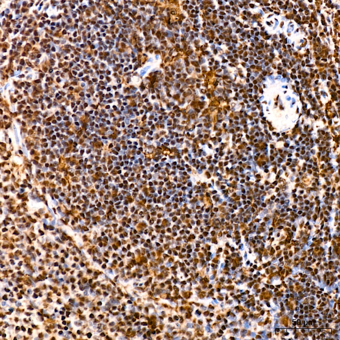 Immunohistochemistry: SFRS3 Antibody (9A1Z4) [NBP3-16741] - Immunohistochemistry analysis of SFRS3 in paraffin-embedded rat spleen tissue using SFRS3 Rabbit mAb  at a dilution of 1:800 (40x lens). High pressure antigen retrieval was performed with 0.01 M citrate buffer (pH 6.0) prior to IHC staining.