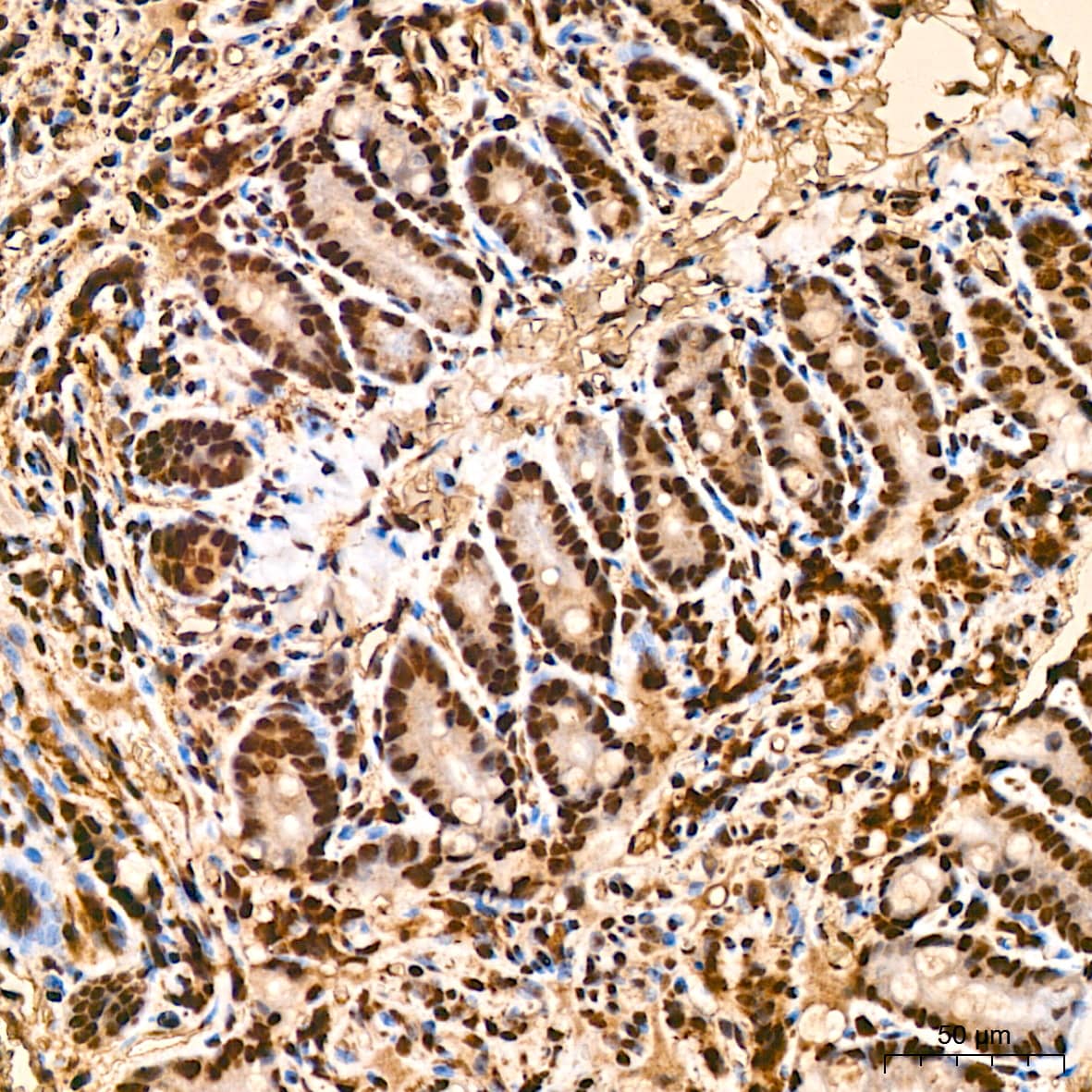 Immunohistochemistry: SFRS3 Antibody (9A1Z4) [NBP3-16741] - Immunohistochemistry analysis of SFRS3 in paraffin-embedded mouse colon tissue using SFRS3 Rabbit mAb  at a dilution of 1:800 (40x lens). High pressure antigen retrieval was performed with 0.01 M citrate buffer (pH 6.0) prior to IHC staining.