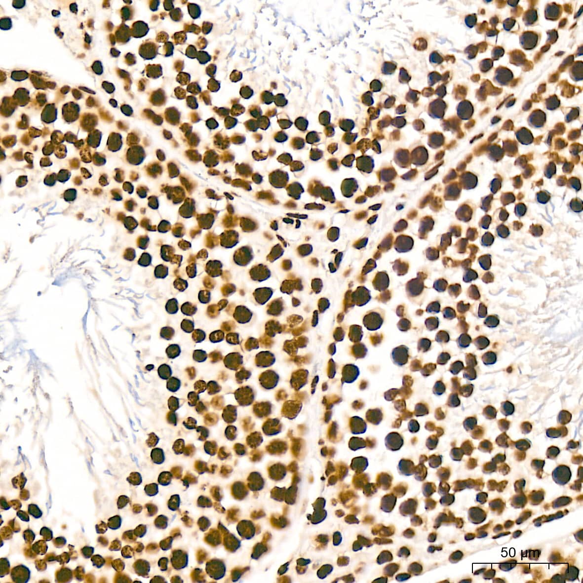 Immunohistochemistry: Histone H2AY/macroH2A.1 Antibody (4D2O4) [NBP3-16743] - Immunohistochemistry analysis of Histone H2AY/macroH2A.1 in paraffin-embedded rat testis tissue using Histone H2AY/macroH2A.1 Rabbit mAb  at a dilution of 1:200 (40x lens). High pressure antigen retrieval was performed with 0.01 M citrate buffer (pH 6.0) prior to IHC staining.