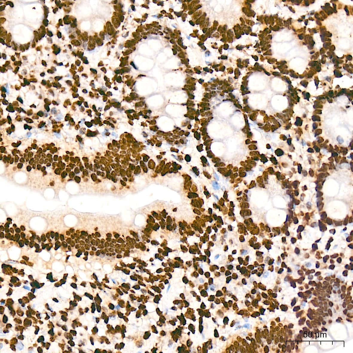 Immunohistochemistry: Histone H2AY/macroH2A.1 Antibody (4D2O4) [NBP3-16743] - Immunohistochemistry analysis of Histone H2AY/macroH2A.1 in paraffin-embedded human colon tissue using Histone H2AY/macroH2A.1 Rabbit mAb  at a dilution of 1:200 (40x lens). High pressure antigen retrieval was performed with 0.01 M citrate buffer (pH 6.0) prior to IHC staining.