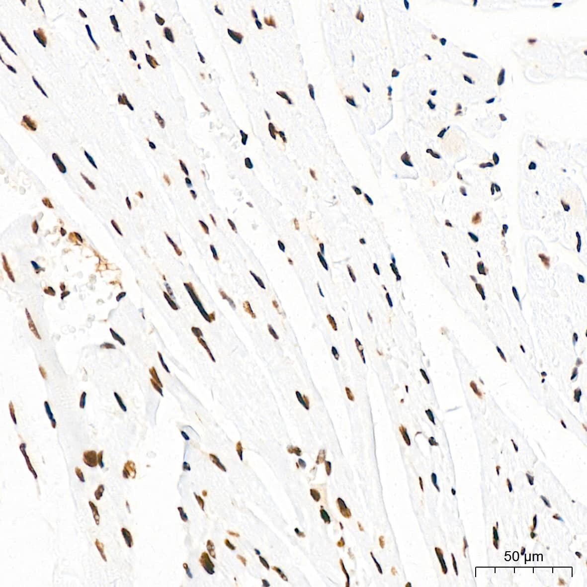 Immunohistochemistry: KHSRP Antibody (4V4O1) [NBP3-16746] - Immunohistochemistry analysis of KHSRP in paraffin-embedded mouse heart tissue using KHSRP Rabbit mAb  at a dilution of 1:200 (40x lens).High pressure antigen retrieval was performed with 0.01 M citrate buffer (pH 6.0) prior to IHC staining.