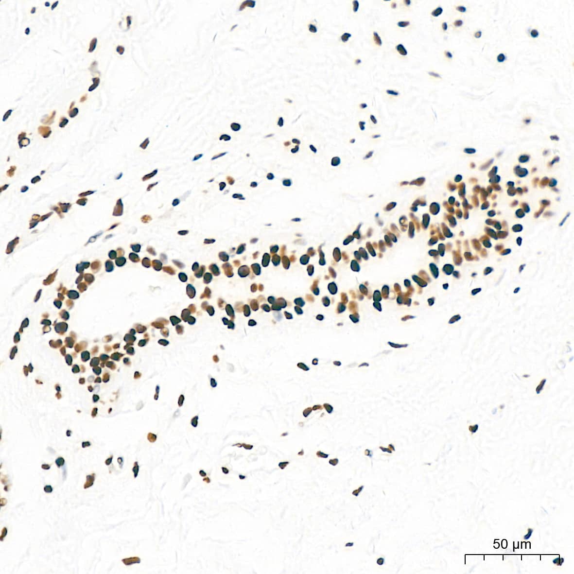 Immunohistochemistry: KHSRP Antibody (4V4O1) [NBP3-16746] - Immunohistochemistry analysis of KHSRP in paraffin-embedded human breast tissue using KHSRP Rabbit mAb  at a dilution of 1:200 (40x lens).High pressure antigen retrieval was performed with 0.01 M citrate buffer (pH 6.0) prior to IHC staining.