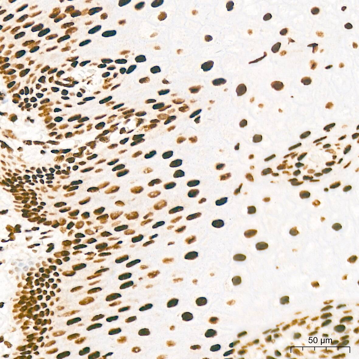 Immunohistochemistry: KHSRP Antibody (4V4O1) [NBP3-16746] - Immunohistochemistry analysis of KHSRP in paraffin-embedded human esophagus tissue using KHSRP Rabbit mAb  at a dilution of 1:200 (40x lens).High pressure antigen retrieval was performed with 0.01 M citrate buffer (pH 6.0) prior to IHC staining.