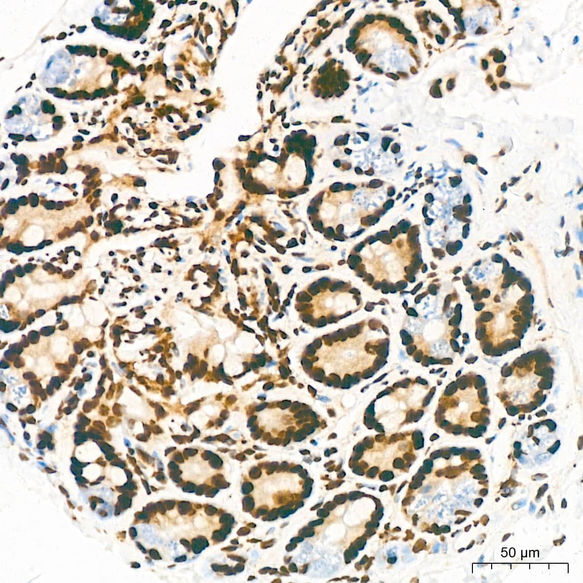 Immunohistochemistry: KHSRP Antibody (4V4O1) [NBP3-16746] - Immunohistochemistry analysis of KHSRP in paraffin-embedded mouse colon tissue using KHSRP Rabbit mAb  at a dilution of 1:200 (40x lens).High pressure antigen retrieval was performed with 0.01 M citrate buffer (pH 6.0) prior to IHC staining.