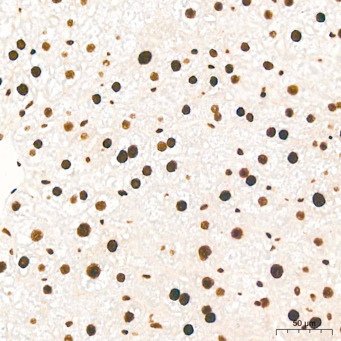 Immunohistochemistry: KHSRP Antibody (4V4O1) [NBP3-16746] - Immunohistochemistry analysis of KHSRP in paraffin-embedded mouse liver tissue using KHSRP Rabbit mAb  at a dilution of 1:200 (40x lens).High pressure antigen retrieval was performed with 0.01 M citrate buffer (pH 6.0) prior to IHC staining.