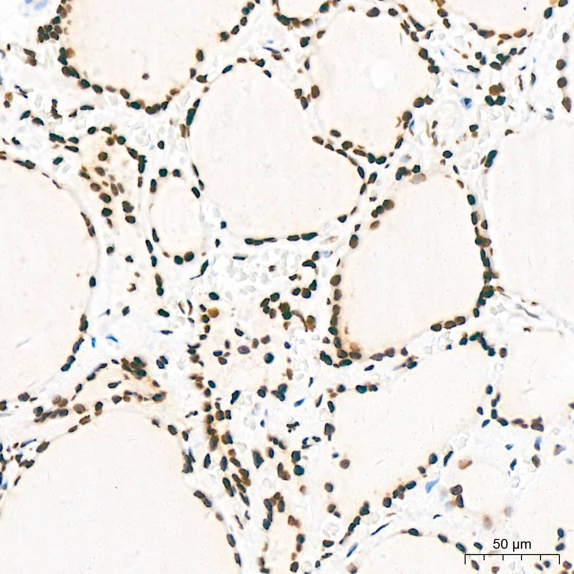 Immunohistochemistry: KHSRP Antibody (4V4O1) [NBP3-16746] - Immunohistochemistry analysis of KHSRP in paraffin-embedded human thyroid tissue using KHSRP Rabbit mAb  at a dilution of 1:200 (40x lens).High pressure antigen retrieval was performed with 0.01 M citrate buffer (pH 6.0) prior to IHC staining.