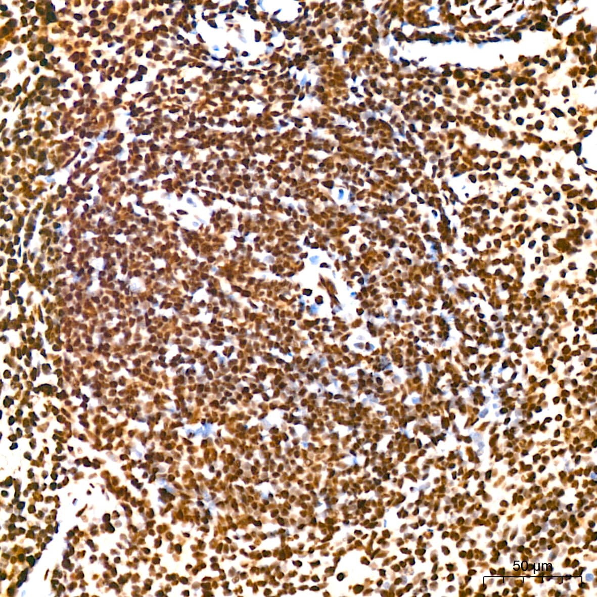 Immunohistochemistry: KHSRP Antibody (4V4O1) [NBP3-16746] - Immunohistochemistry analysis of KHSRP in paraffin-embedded mouse spleen tissue using KHSRP Rabbit mAb  at a dilution of 1:200 (40x lens).High pressure antigen retrieval was performed with 0.01 M citrate buffer (pH 6.0) prior to IHC staining.