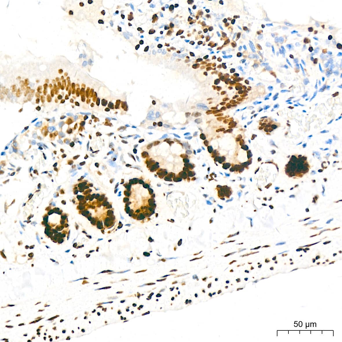 Immunohistochemistry: KHSRP Antibody (4V4O1) [NBP3-16746] - Immunohistochemistry analysis of KHSRP in paraffin-embedded rat colon tissue using KHSRP Rabbit mAb  at a dilution of 1:200 (40x lens).High pressure antigen retrieval was performed with 0.01 M citrate buffer (pH 6.0) prior to IHC staining.